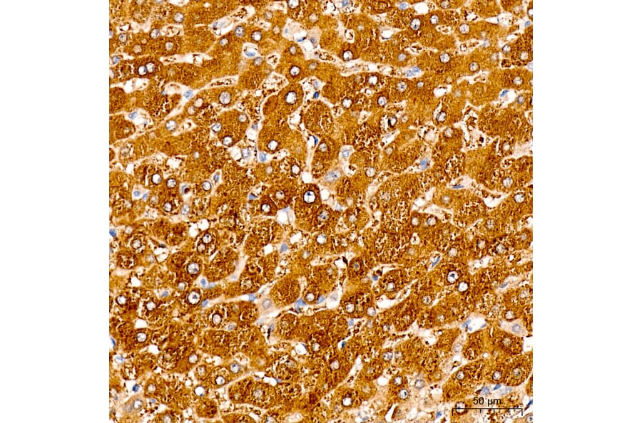 Immunohistochemistry - Anti-SLC25A29 Antibody (A329855) - Antibodies.com