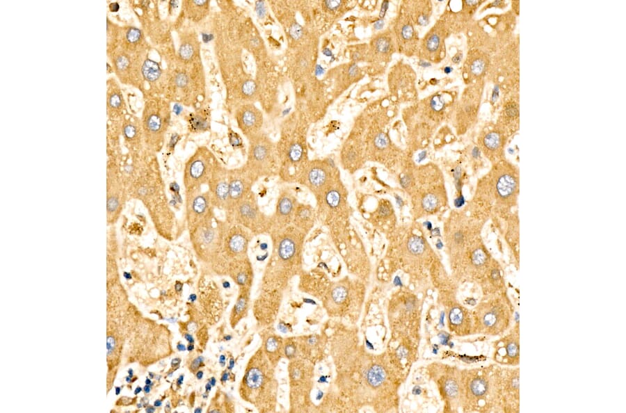 Immunohistochemistry - Anti-SLC27A6 Antibody (A329856) - Antibodies.com