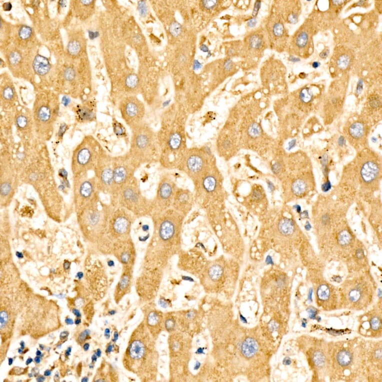 Immunohistochemistry - Anti-SLC27A6 Antibody (A329856) - Antibodies.com