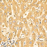 Immunohistochemistry - Anti-SLC27A6 Antibody (A329856) - Antibodies.com