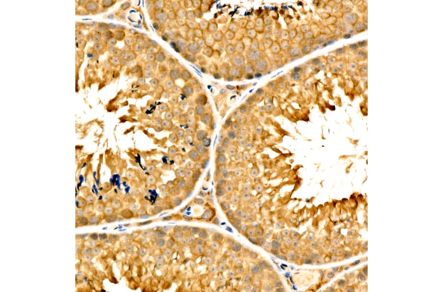 Immunohistochemistry - Anti-SLC27A6 Antibody (A329856) - Antibodies.com