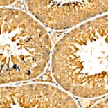 Immunohistochemistry - Anti-SLC27A6 Antibody (A329856) - Antibodies.com