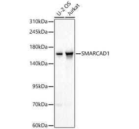 Western Blot - Anti-SMARCAD1 Antibody (A329860) - Antibodies.com