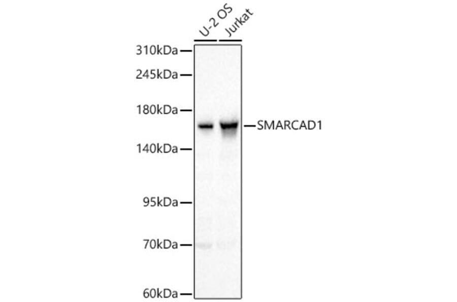 Western Blot - Anti-SMARCAD1 Antibody (A329860) - Antibodies.com