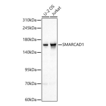 Western Blot - Anti-SMARCAD1 Antibody (A329860) - Antibodies.com