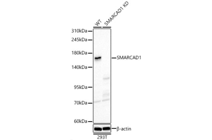 Western Blot - Anti-SMARCAD1 Antibody (A329860) - Antibodies.com