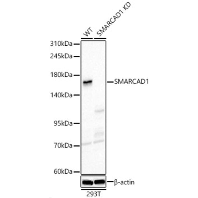 Western Blot - Anti-SMARCAD1 Antibody (A329860) - Antibodies.com