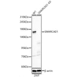 Western Blot - Anti-SMARCAD1 Antibody (A329860) - Antibodies.com