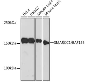 Western Blot - Anti-BAF155 Antibody [ARC0948] (A329861) - Antibodies.com