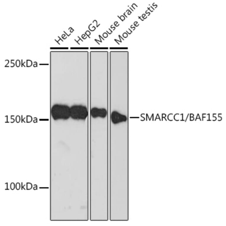 Western Blot - Anti-BAF155 Antibody [ARC0948] (A329861) - Antibodies.com