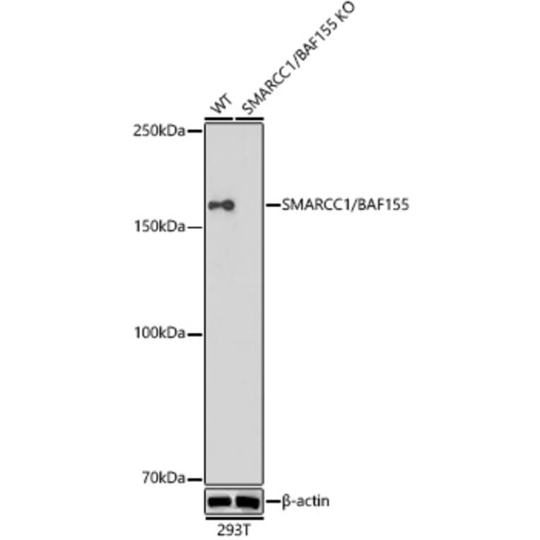 Western Blot - Anti-BAF155 Antibody [ARC0948] (A329861) - Antibodies.com