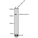 Western Blot - Anti-BAF155 Antibody [ARC0948] (A329861) - Antibodies.com