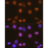 Immunofluorescence - Anti-BAF155 Antibody [ARC0948] (A329861) - Antibodies.com