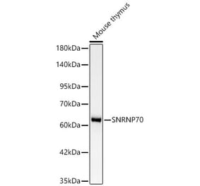 Western Blot - Anti-SNRNP70 Antibody [ARC64486] (A329863) - Antibodies.com