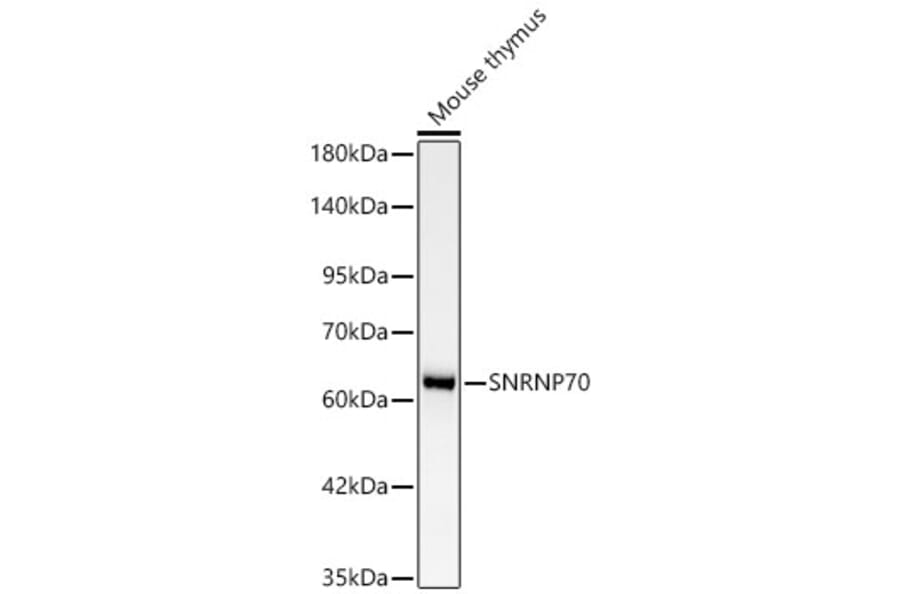 Western Blot - Anti-SNRNP70 Antibody [ARC64486] (A329863) - Antibodies.com