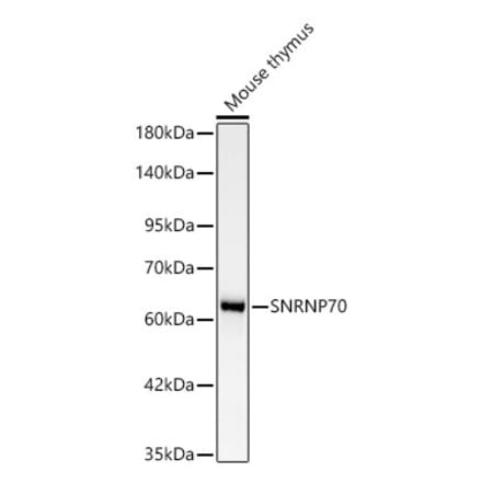 Western Blot - Anti-SNRNP70 Antibody [ARC64486] (A329863) - Antibodies.com