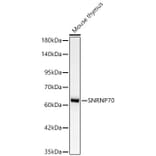 Western Blot - Anti-SNRNP70 Antibody [ARC64486] (A329863) - Antibodies.com