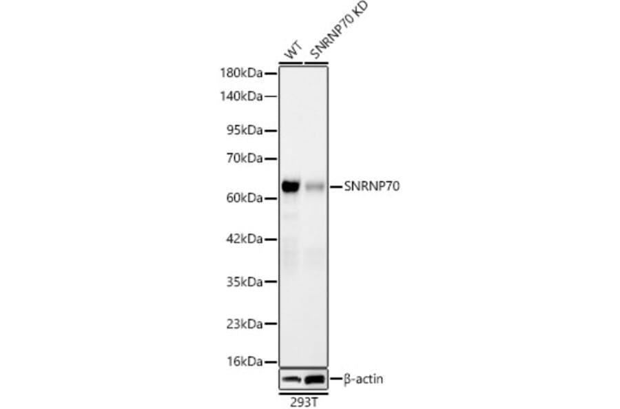 Western Blot - Anti-SNRNP70 Antibody [ARC64486] (A329863) - Antibodies.com
