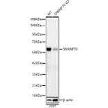 Western Blot - Anti-SNRNP70 Antibody [ARC64486] (A329863) - Antibodies.com