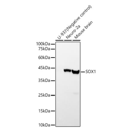 Western Blot - Anti-SOX1 Antibody [ARC57513] (A329865) - Antibodies.com