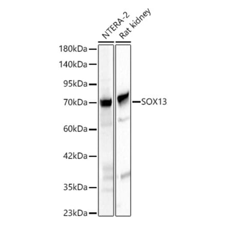 Western Blot - Anti-SOX13 Antibody (A329866) - Antibodies.com