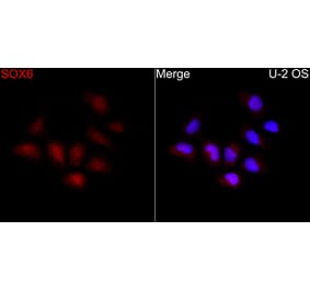 Immunofluorescence - Anti-SOX6 Antibody (A329867) - Antibodies.com
