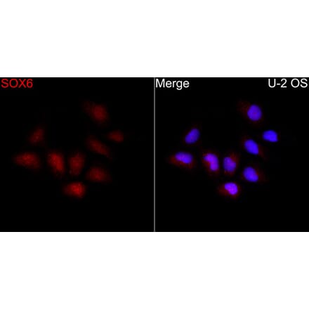 Immunofluorescence - Anti-SOX6 Antibody (A329867) - Antibodies.com
