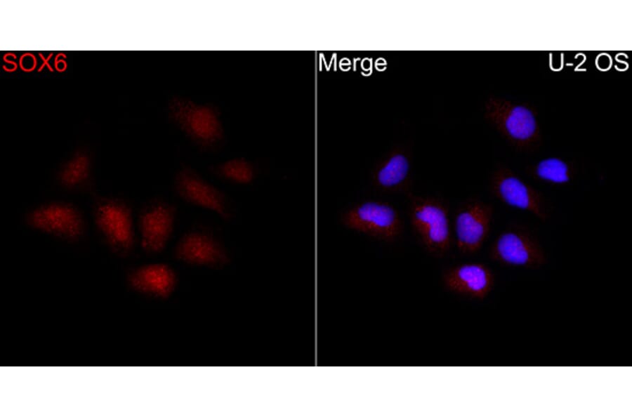 Immunofluorescence - Anti-SOX6 Antibody (A329867) - Antibodies.com