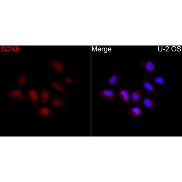 Immunofluorescence - Anti-SOX6 Antibody (A329867) - Antibodies.com