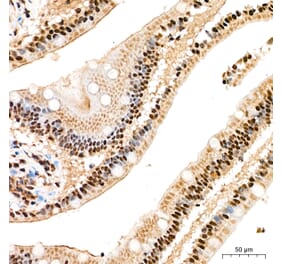 Immunohistochemistry - Anti-SP1 Antibody (A329868) - Antibodies.com