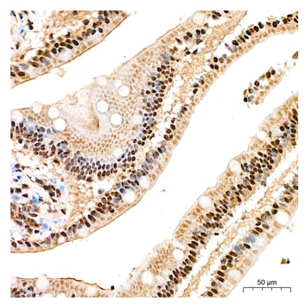 Immunohistochemistry - Anti-SP1 Antibody (A329868) - Antibodies.com
