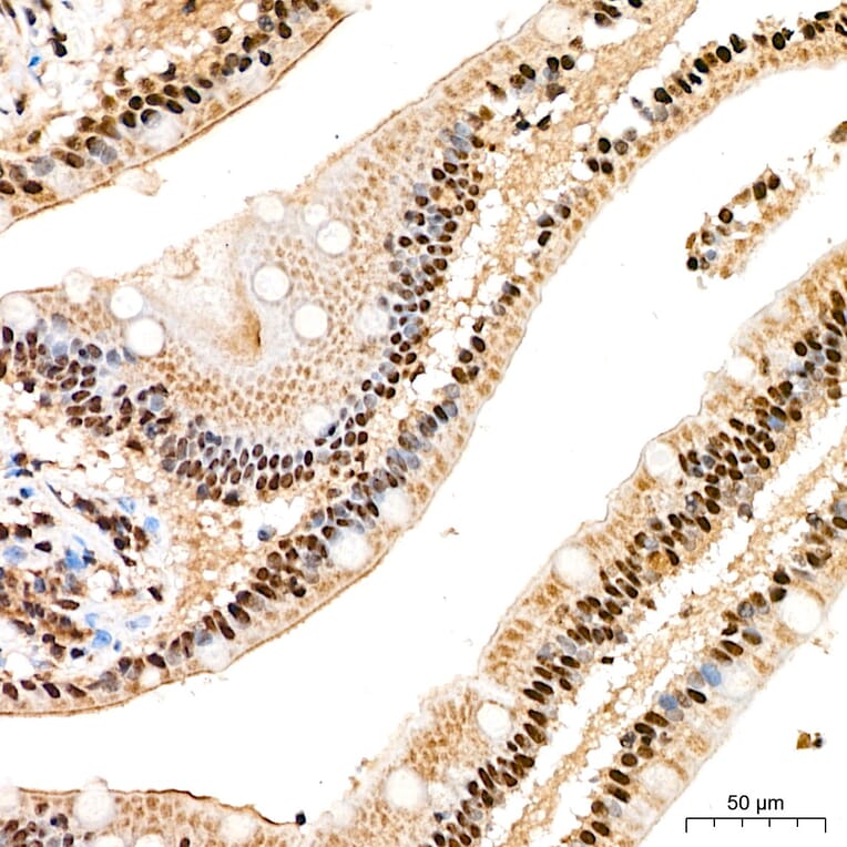 Immunohistochemistry - Anti-SP1 Antibody (A329868) - Antibodies.com
