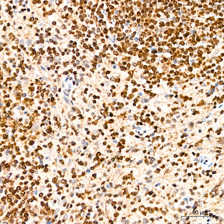 Immunohistochemistry - Anti-SP1 Antibody (A329868) - Antibodies.com