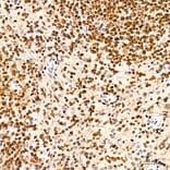 Immunohistochemistry - Anti-SP1 Antibody (A329868) - Antibodies.com