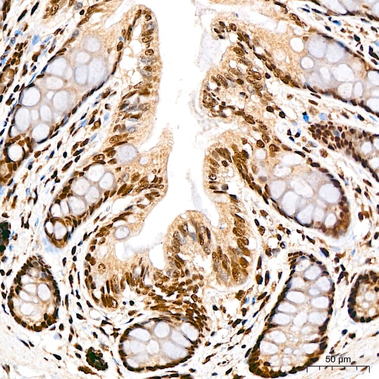 Immunohistochemistry - Anti-SP1 Antibody (A329868) - Antibodies.com