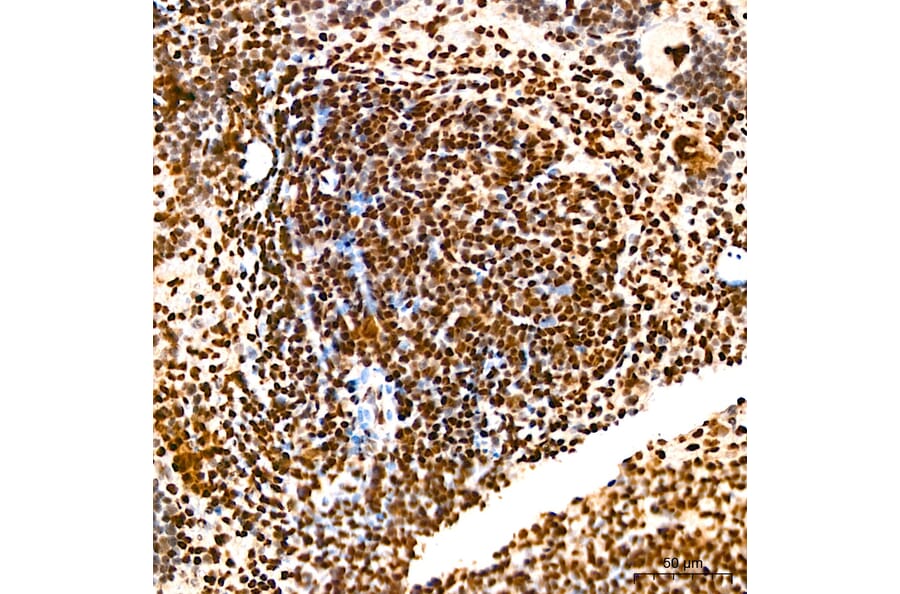 Immunohistochemistry - Anti-SP1 Antibody (A329868) - Antibodies.com