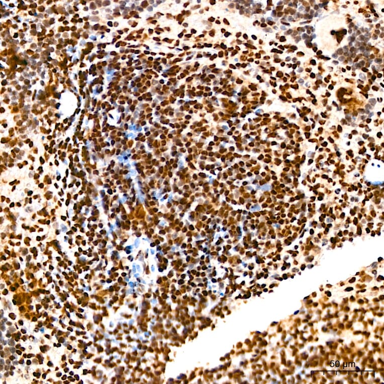Immunohistochemistry - Anti-SP1 Antibody (A329868) - Antibodies.com