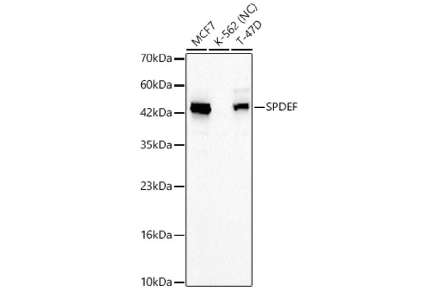 Western Blot - Anti-SPDEF Antibody (A329869) - Antibodies.com