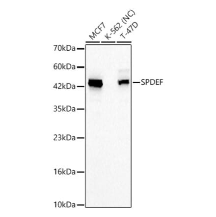 Western Blot - Anti-SPDEF Antibody (A329869) - Antibodies.com