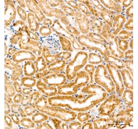 Immunohistochemistry - Anti-SPHK1 Antibody (A329870) - Antibodies.com