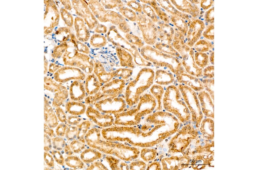 Immunohistochemistry - Anti-SPHK1 Antibody (A329870) - Antibodies.com