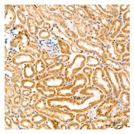 Immunohistochemistry - Anti-SPHK1 Antibody (A329870) - Antibodies.com