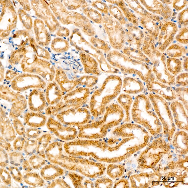 Immunohistochemistry - Anti-SPHK1 Antibody (A329870) - Antibodies.com