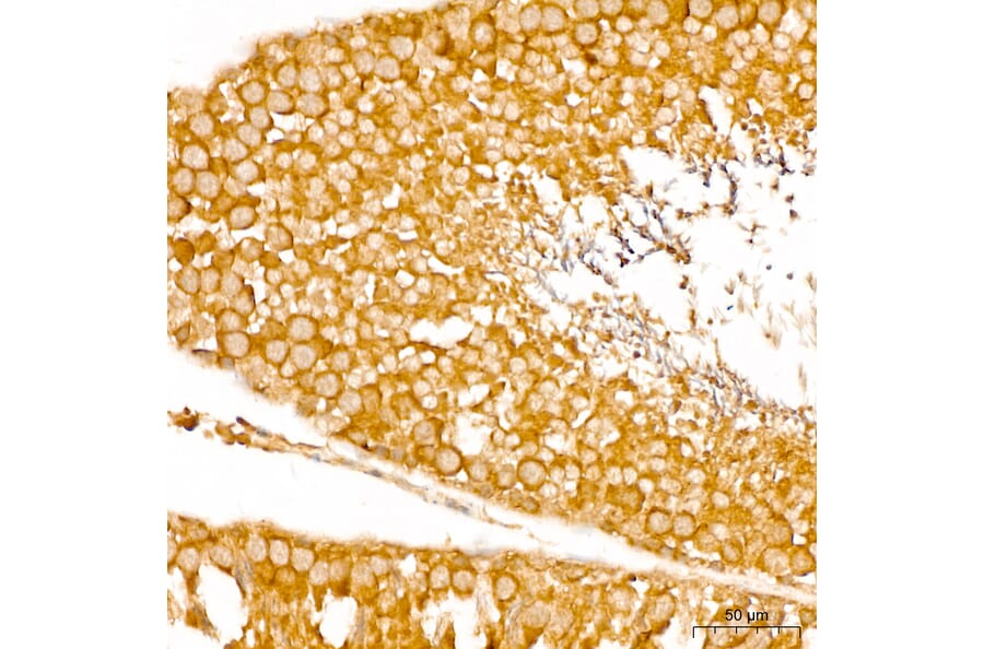 Immunohistochemistry - Anti-SPHK1 Antibody (A329870) - Antibodies.com