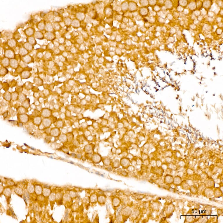 Immunohistochemistry - Anti-SPHK1 Antibody (A329870) - Antibodies.com