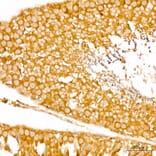 Immunohistochemistry - Anti-SPHK1 Antibody (A329870) - Antibodies.com