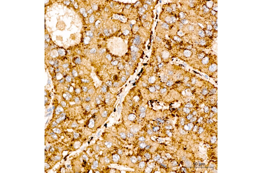 Immunohistochemistry - Anti-SPHK1 Antibody (A329870) - Antibodies.com