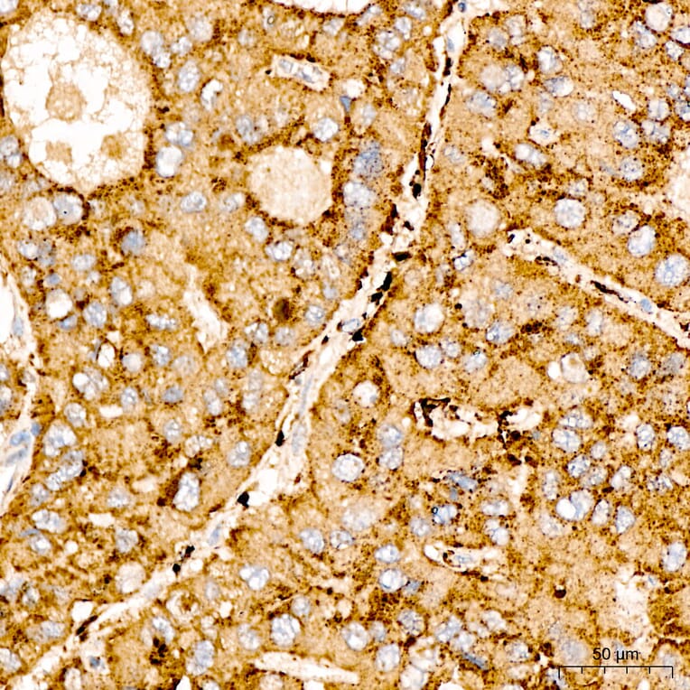 Immunohistochemistry - Anti-SPHK1 Antibody (A329870) - Antibodies.com