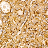 Immunohistochemistry - Anti-SPHK1 Antibody (A329870) - Antibodies.com