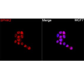 Immunofluorescence - Anti-SPHK2 Antibody (A329871) - Antibodies.com